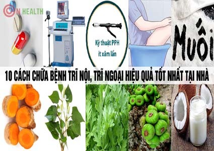 10 cách chữa bệnh trĩ nội, trĩ ngoại hiệu quả tốt nhất nhanh nhất