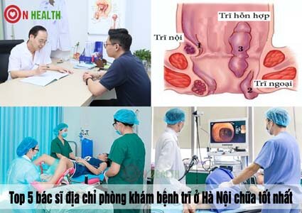 Top 5 bác sĩ & địa chỉ phòng khám bệnh trĩ ở Hà Nội chữa tốt nhất