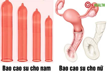 Hướng dẫn dùng bao cao su đúng cách cho nam và nữ