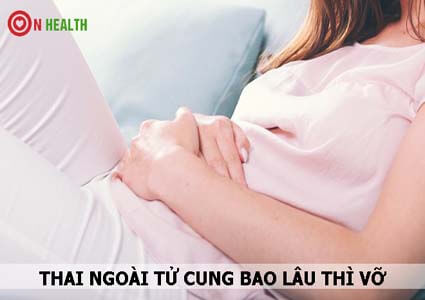 Thai ngoài tử cung bao lâu thì vỡ?