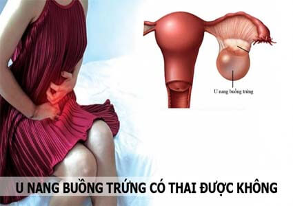 Đã bị u nang buồng trứng có thai được không