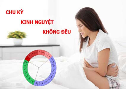 Cách trị chu kỳ kinh nguyệt không đều từ nguyên nhân, dấu hiệu