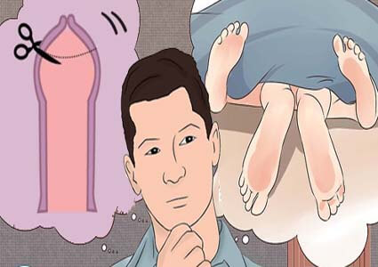 Phải kiêng quan hệ bao lâu sau khi cắt bao quy đầu?