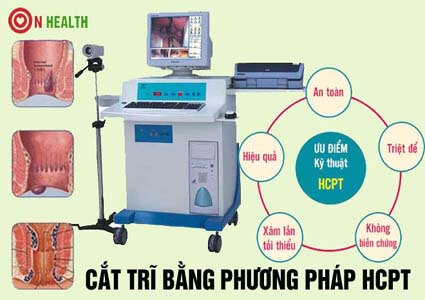 Cắt trĩ bằng phương pháp HCPT là gì? Ở đâu? Bao nhiêu tiền?