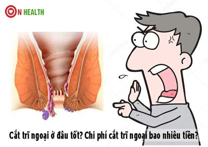 Bệnh trĩ ngoại là gì? Hình ảnh, dấu hiệu và những nguy hiểm