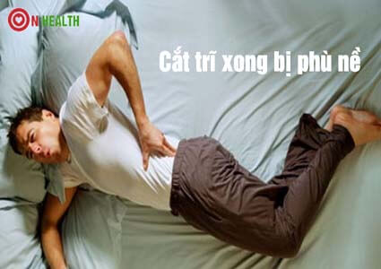 Cắt trĩ xong bị phù nề bao lâu thì khỏi?