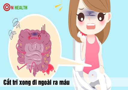 Cắt trĩ xong đi ngoài ra máu có nguy hiểm không?