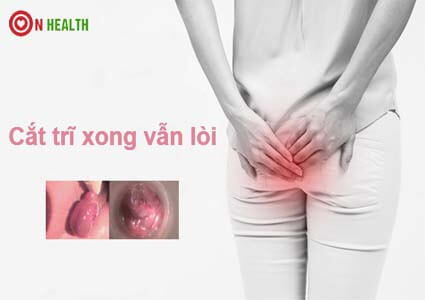 Cắt trĩ xong vẫn lòi có phải bị lại không? Có nên cắt bỏ không?