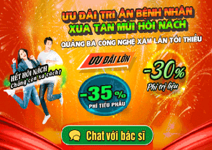 Cắt tuyến mồ hôi nách giá bao nhiêu? Chi phí trị vĩnh viễn