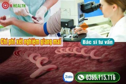 Chi phí xét nghiệm bệnh giang mai hết bao nhiêu tiền 2025