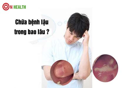 Chữa bệnh lậu trong bao lâu? Bệnh lậu có chữa khỏi được không?