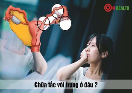 Thông tắc vòi trứng ở đâu? Chi phí thông tắc vòi trứng và cách chữa trị