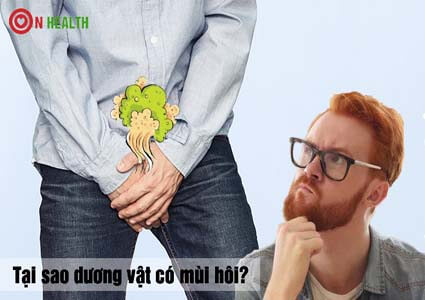 Tại sao dương vật có mùi hôi tanh và ngứa? là bị bệnh gì?