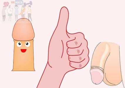 Hình ảnh bao quy đầu bình thường và bị hẹp, dài, viêm
