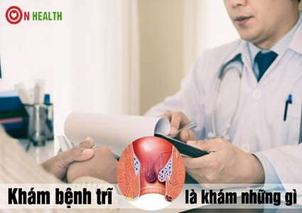 Khám trĩ như thế nào? Khám trĩ là khám những gì?