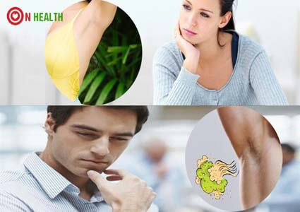 Bệnh hôi nách có lây không? bị qua đường nào?
