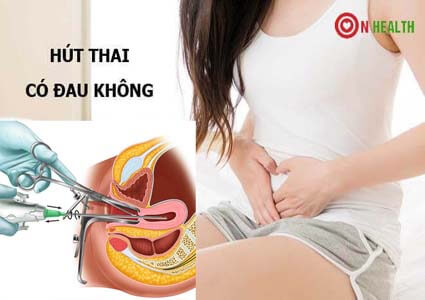 Hút thai có đau không? Quy trình 3 bước hút thai an toàn
