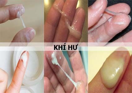 Khí hư là gì và tại sao khí hư lại ra nhiều bất thường