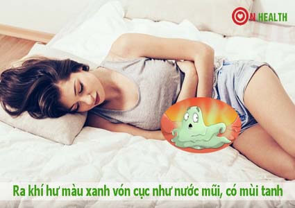 Ra khí hư màu xanh vón cục như nước mũi, có mùi tanh