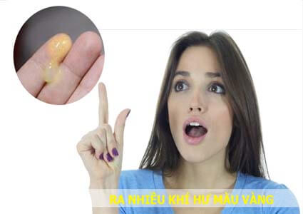Ra nhiều Khí Hư Màu Vàng đặc dính có mùi hôi, tanh