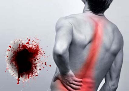 Tại Sao Viêm Đường Tiết Niệu Gây Đau Lưng, Ra Máu