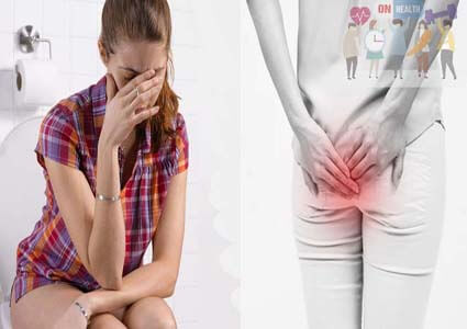 Thuốc Chữa Bệnh Trĩ Hiệu Quả Nhất Hiện Nay