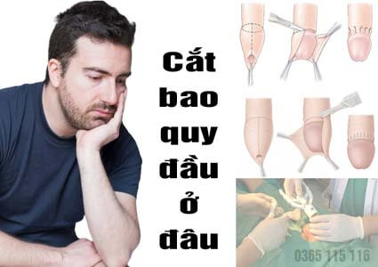 16 địa chỉ cắt bao quy đầu ở đâu tốt nhất uy tín tại Hà Nội
