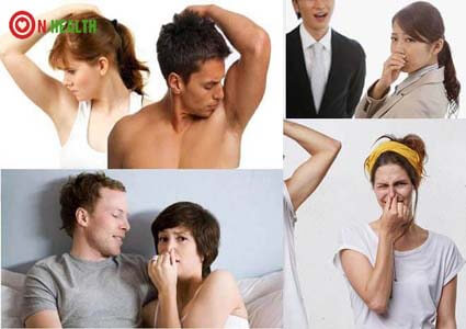 Vì sao bị hôi nách? Nguyên nhân bị hôi nách là gì?