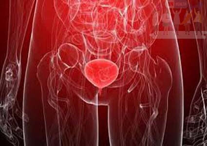 Viêm Bàng Quang Cấp Có Nguy Hiểm Không?