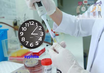 Xét nghiệm rpr và tpha là gì? bao lâu có kết quả chính xác