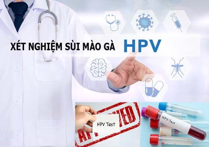 Xét Nghiệm HPV Sùi Mào Gà Ở Đâu? Bao Lâu Có Kết Quả