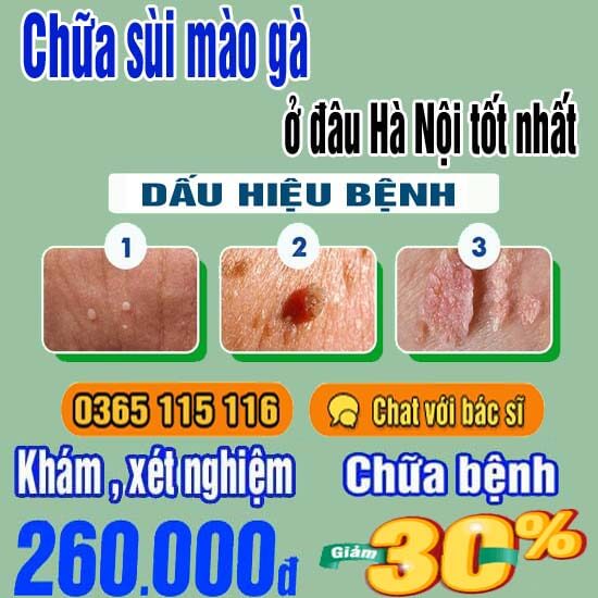 Top 10 địa chỉ chữa bệnh sùi mào gà ở đâu Hà Nội tốt nhất