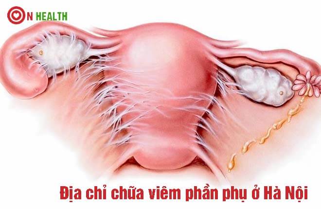 Top 6 địa chỉ chữa viêm phần phụ tốt nhất ở Hà Nội