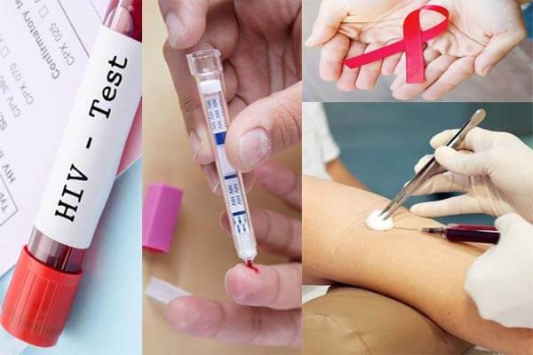 Top 10 địa chỉ khám xét nghiệm HIV ở đâu Hà Nội tốt nhất