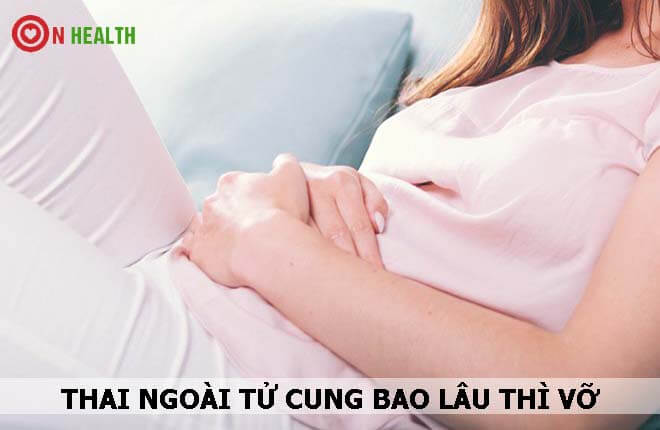Thai ngoài tử cung bao lâu thì vỡ